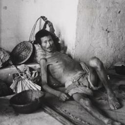 Starving Man