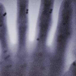 X-ray photograph of lead sh...