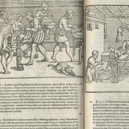 Chirurgiae...libri septem