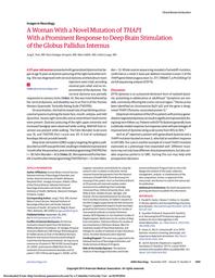 thumbnail for Vanegas.2015.JAMANeurol.AWomanWith a NovelMutation of THAP1.pdf