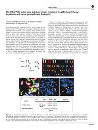 thumbnail for Subramaniyam et al Leukemia 2006.pdf