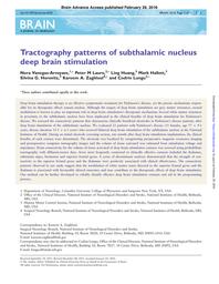 thumbnail for Vanegas.2016.Brain.Tractography patterns of subthalamic nucleus.pdf