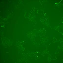 thumbnail for Movie_C_1_js006_slc101m_gfp.avi